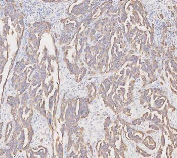 Cytokeratin 19/KRT19 Antibody