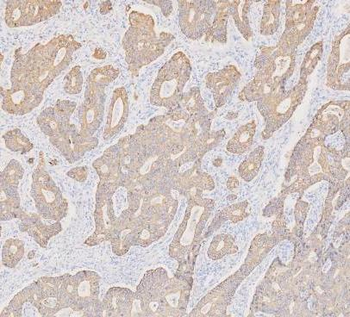 Cytokeratin 19/KRT19 Antibody