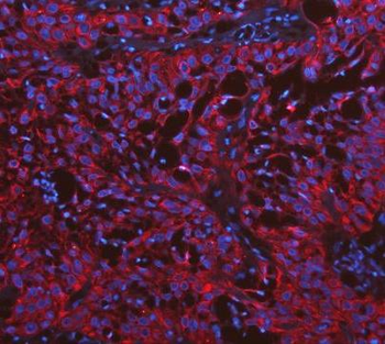 Cytokeratin 19/KRT19 Antibody