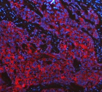 Cytokeratin 19/KRT19 Antibody