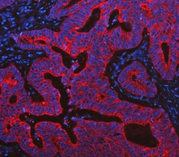 Cytokeratin 19/KRT19 Antibody
