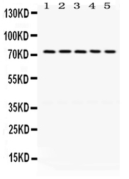 LIMK1 Rabbit Polyclonal Antibody