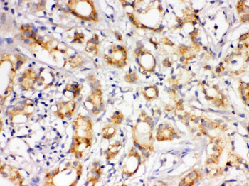 LOXL1 Rabbit Polyclonal Antibody