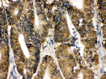 SAPK4/MAPK13 Rabbit Polyclonal Antibody