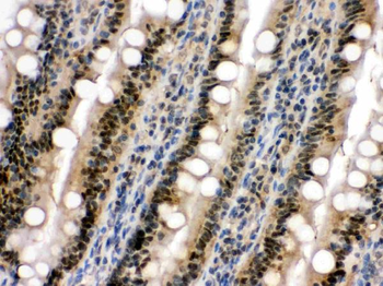 SAPK4/MAPK13 Rabbit Polyclonal Antibody