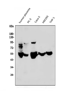 MMP1 Rabbit Polyclonal Antibody