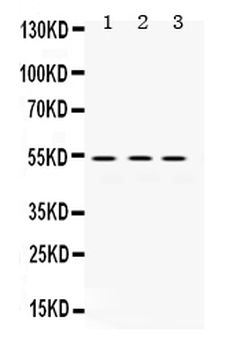 MMP1 Rabbit Polyclonal Antibody