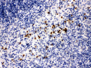 MMP8 Rabbit Polyclonal Antibody