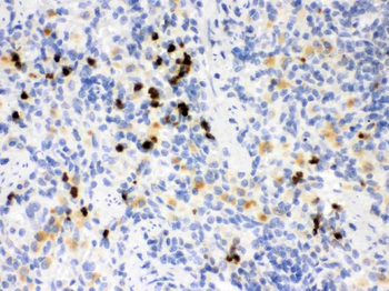 MMP8 Rabbit Polyclonal Antibody