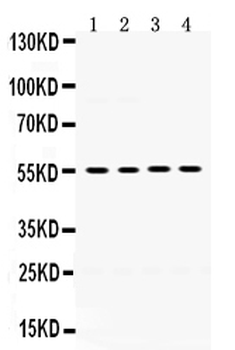 MMP8 Rabbit Polyclonal Antibody