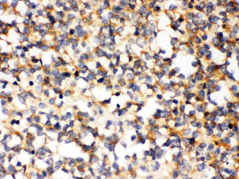 PAK5/PAK7 Rabbit Polyclonal Antibody