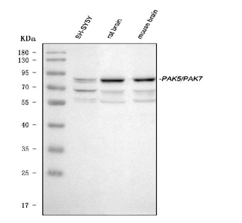 PAK5/PAK7 Rabbit Polyclonal Antibody