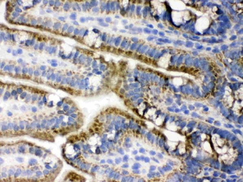 PDPK1 Rabbit Polyclonal Antibody