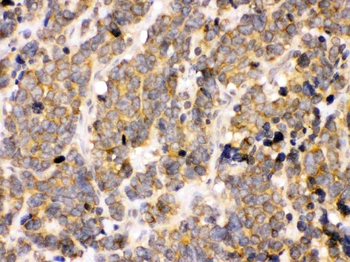 PDPK1 Rabbit Polyclonal Antibody