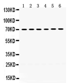 PDPK1 Rabbit Polyclonal Antibody