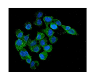AMPK beta 1/PRKAB1 Rabbit Polyclonal Antibody