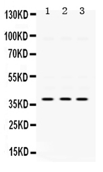 AMPK beta 1/PRKAB1 Rabbit Polyclonal Antibody