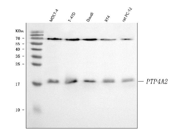 PTP4A2 Rabbit Polyclonal Antibody