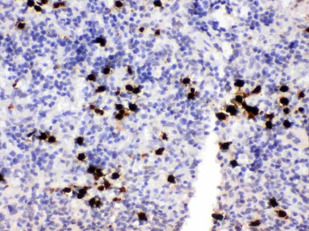 MRP8/S100A8 Rabbit Polyclonal Antibody