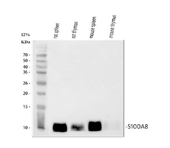 MRP8/S100A8 Rabbit Polyclonal Antibody