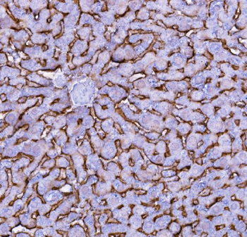 SLC10A1 Rabbit Polyclonal Antibody