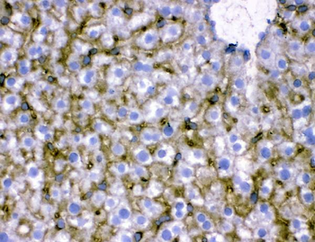 SLC10A1 Rabbit Polyclonal Antibody
