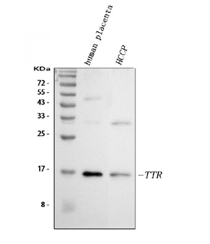 Prealbumin/TTR Rabbit Polyclonal Antibody