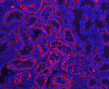 Prealbumin/TTR Rabbit Polyclonal Antibody