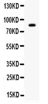 SMURF 2/SMURF2 Rabbit Polyclonal Antibody