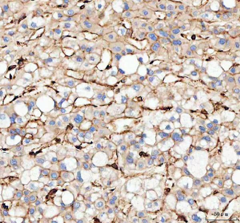 Actin/ACTA1 Antibody