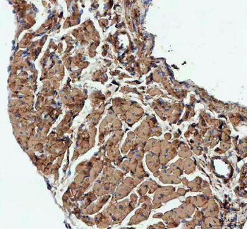 Actin/ACTA1 Antibody