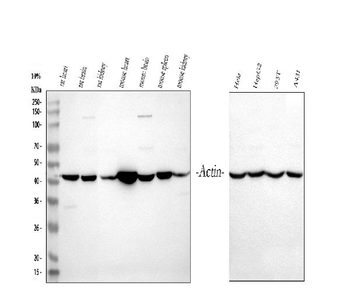 Actin/ACTA1 Antibody