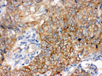 Bag3 Rabbit Polyclonal Antibody