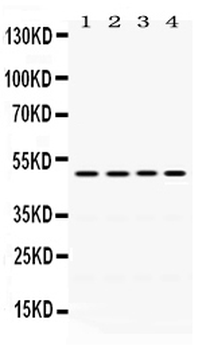 DDB2 Rabbit Polyclonal Antibody
