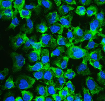 eIF4A2 Rabbit Polyclonal Antibody
