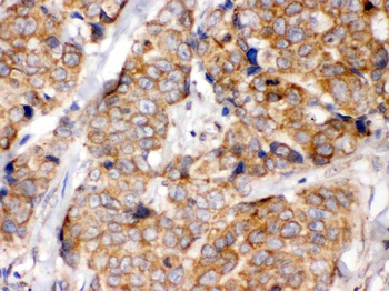 eIF4A2 Rabbit Polyclonal Antibody