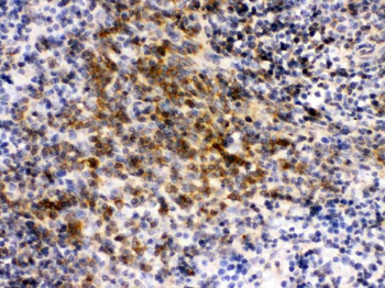 eIF4A2 Rabbit Polyclonal Antibody