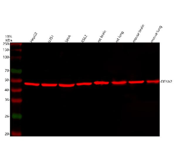 eIF4A2 Rabbit Polyclonal Antibody