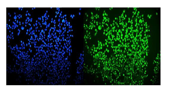 OGT/O-Linked N-Acetylglucosamine Transferase Rabbit Polyclonal Antibody