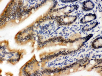 OGT/O-Linked N-Acetylglucosamine Transferase Rabbit Polyclonal Antibody