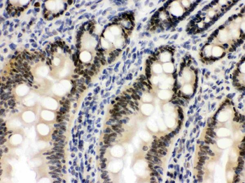 OGT/O-Linked N-Acetylglucosamine Transferase Rabbit Polyclonal Antibody