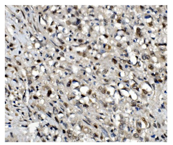 OGT/O-Linked N-Acetylglucosamine Transferase Rabbit Polyclonal Antibody