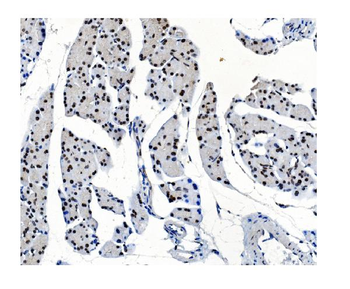 OGT/O-Linked N-Acetylglucosamine Transferase Rabbit Polyclonal Antibody