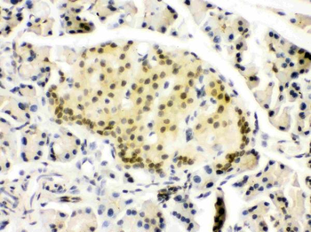 PAX6 Rabbit Polyclonal Antibody