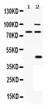 PACE4/PCSK6 Rabbit Polyclonal Antibody
