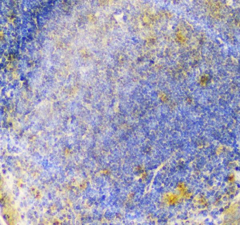ALIX/PDCD6IP Rabbit Polyclonal Antibody