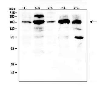 PDGF Receptor alpha/PDGFRA Rabbit Polyclonal Antibody