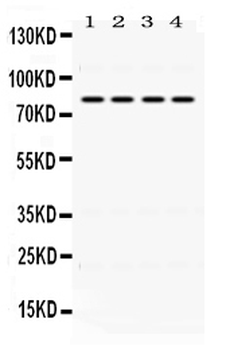 PIGR Rabbit Polyclonal Antibody