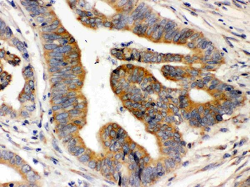 Rab5/RAB5A Rabbit Polyclonal Antibody