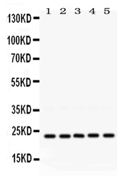 Rab18 Rabbit Polyclonal Antibody
